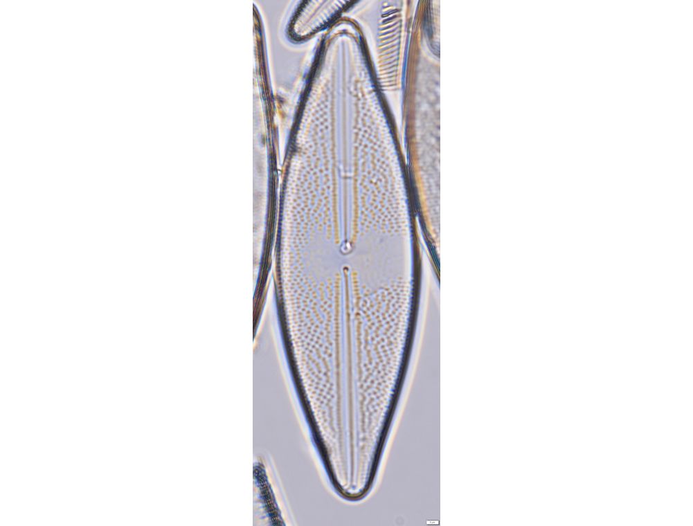 Anomoeoneis sphaerophora