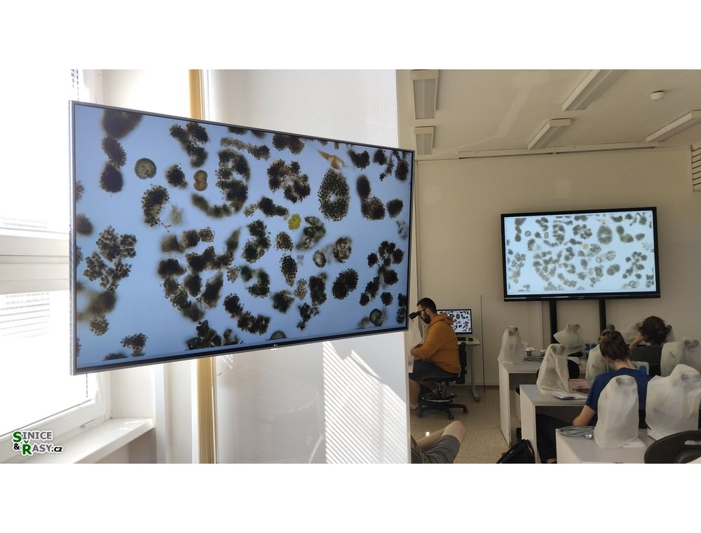 Microcystis