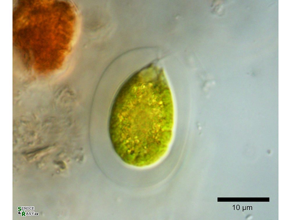 Sphaerellopsis aulata
