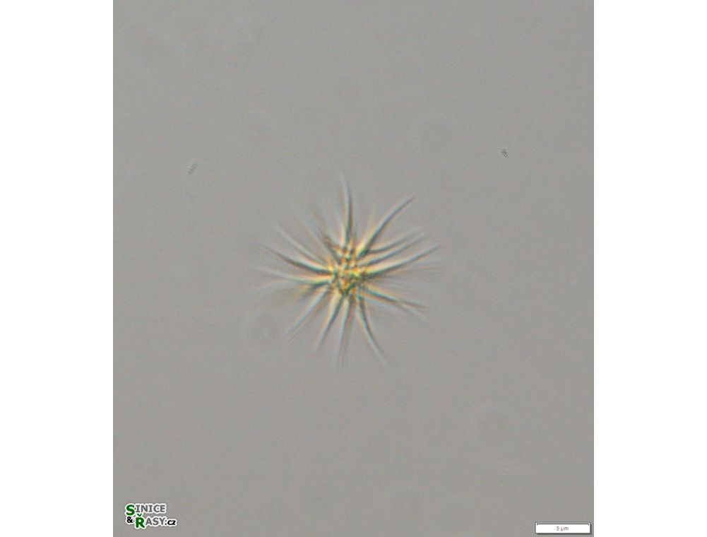 Ankistrodesmus fusiformis