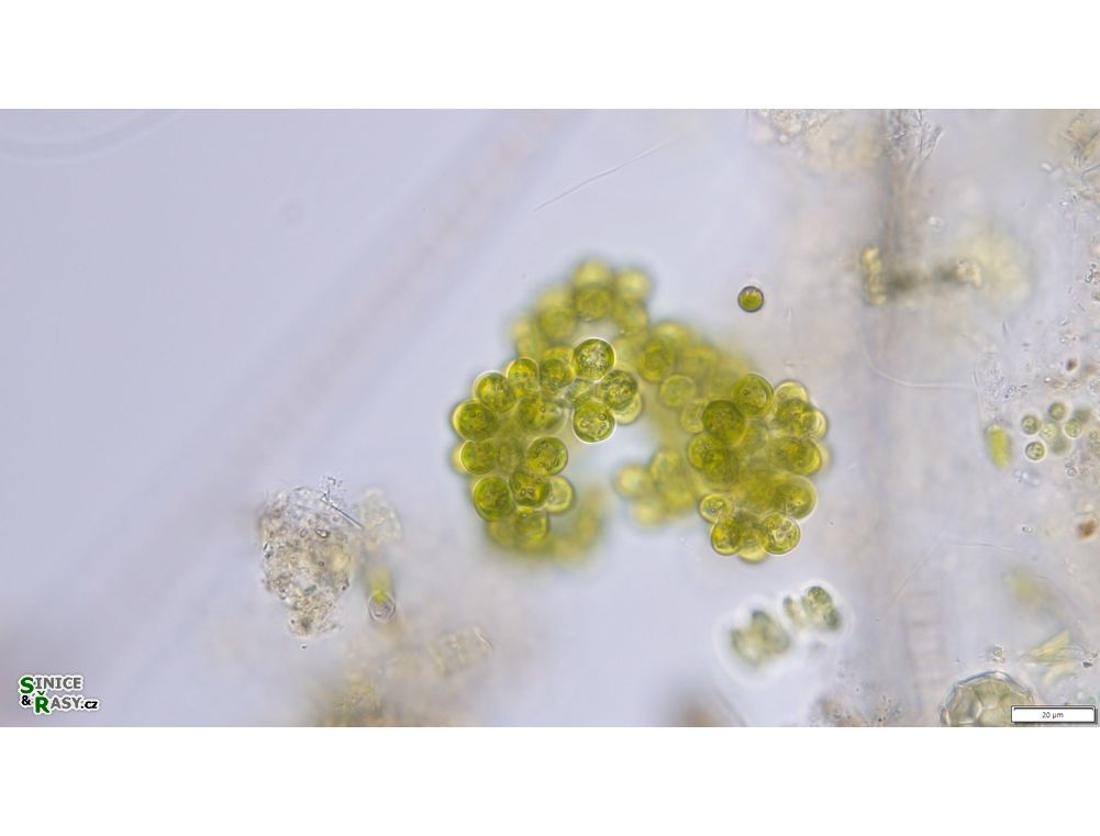 Botryosphaerella sudetica