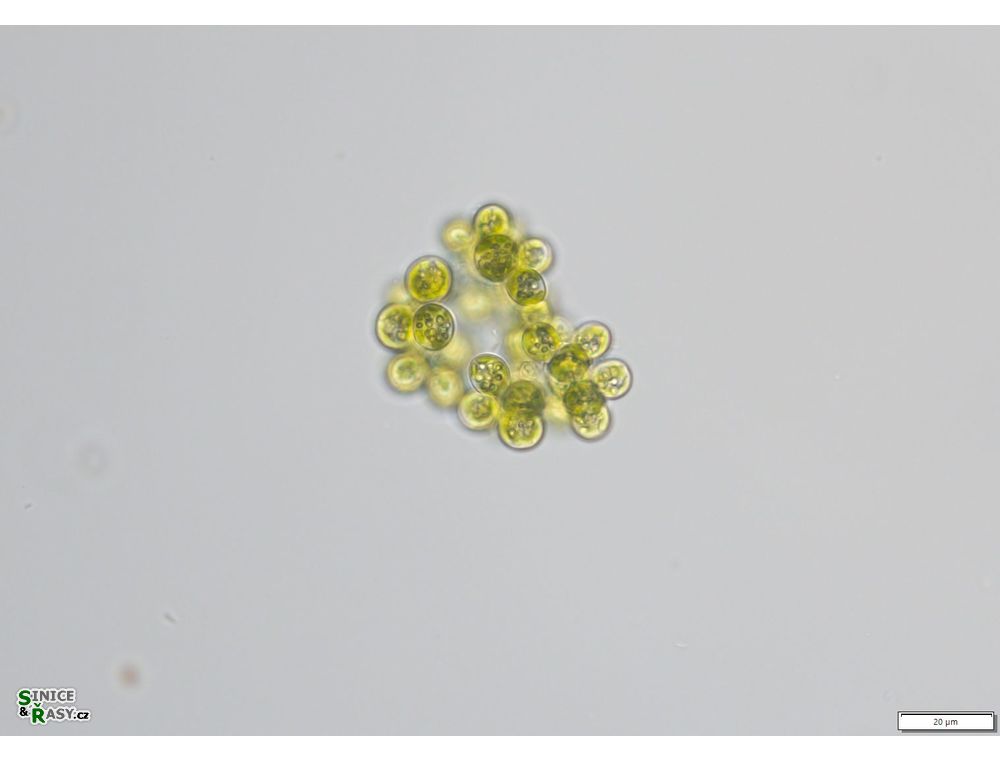 Botryosphaerella sudetica