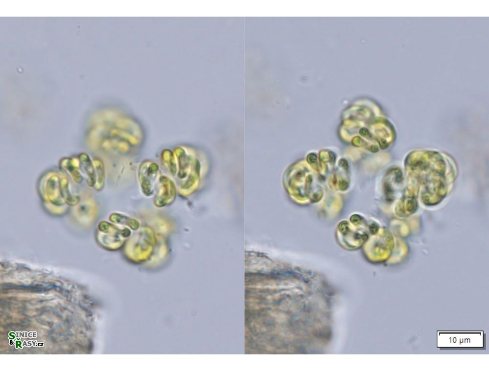 Kirchneriella contorta