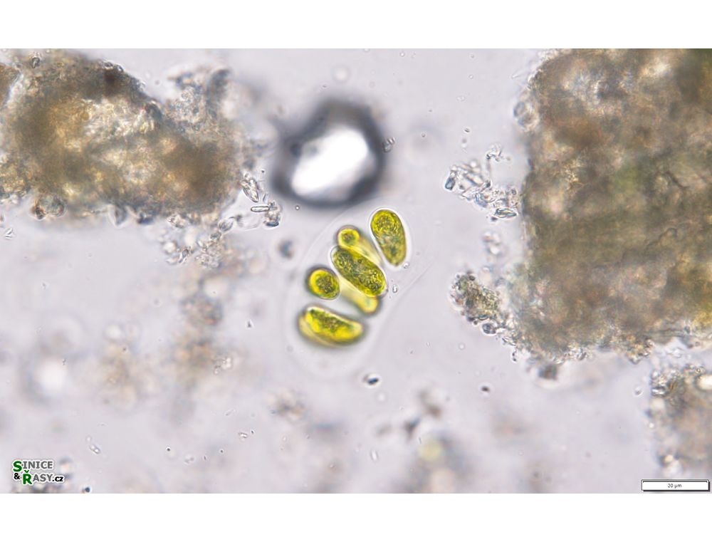 Nephrocytium