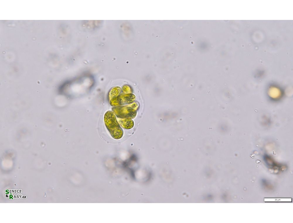 Nephrocytium