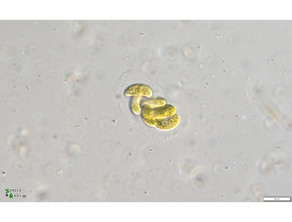 Nephrocytium