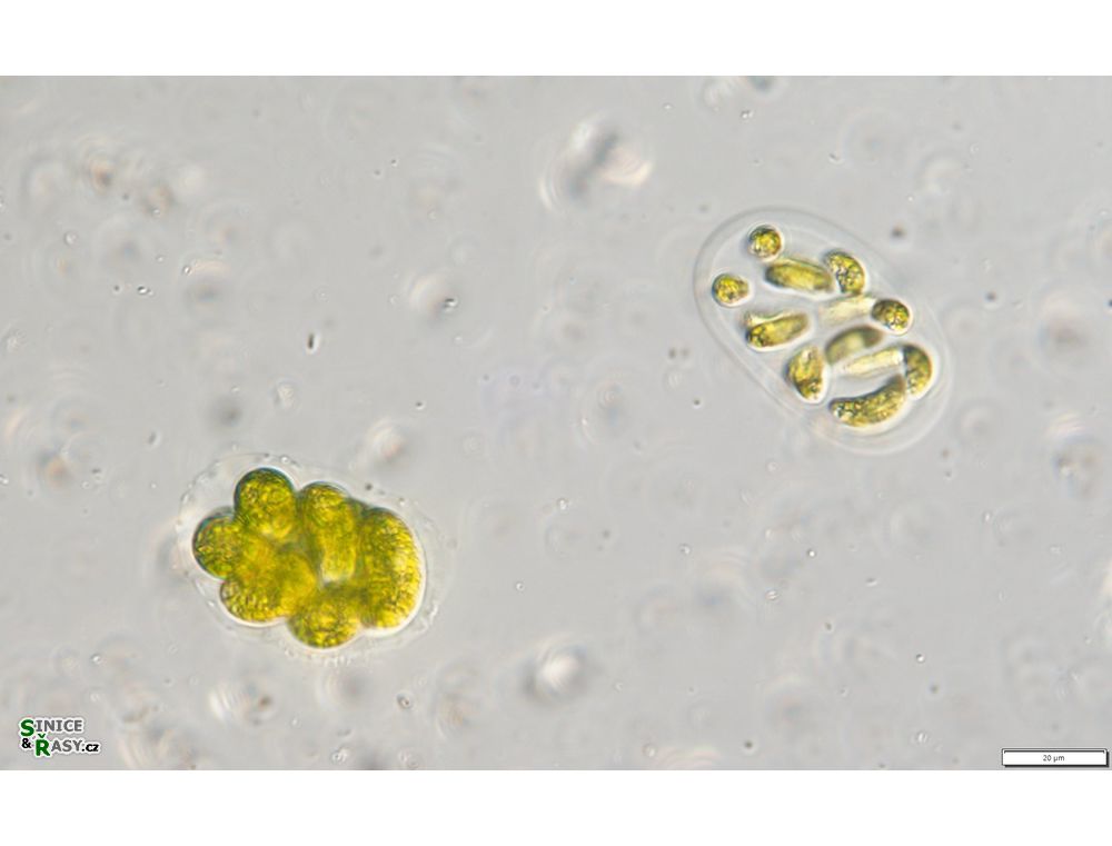 Nephrocytium