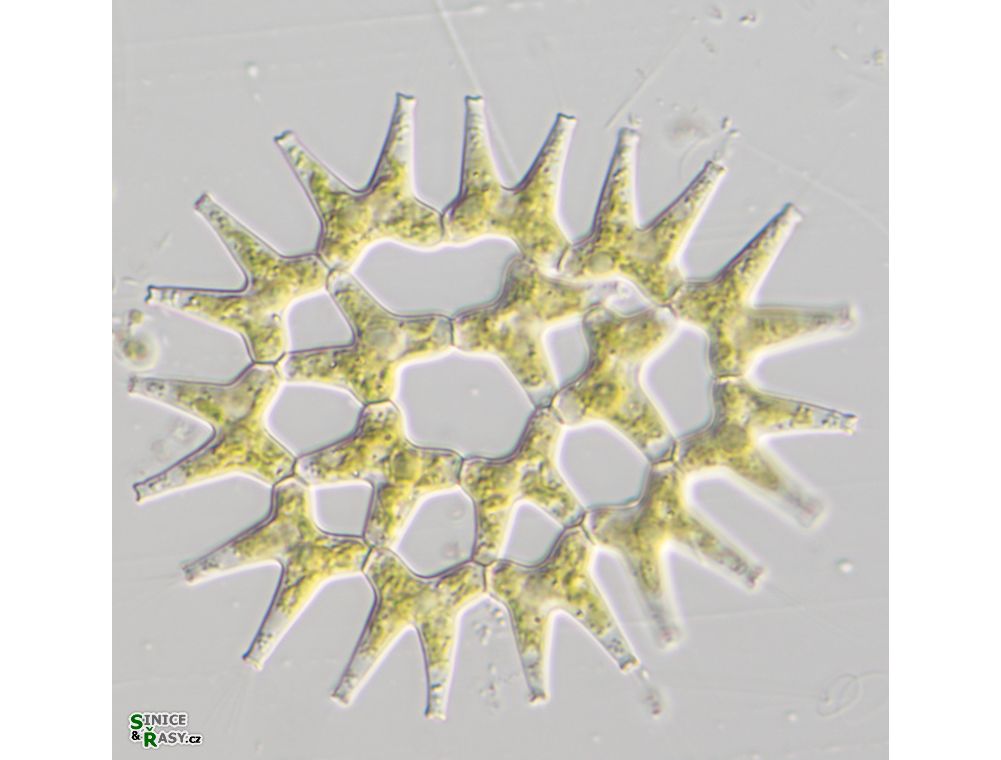 Lacunastrum gracillimum