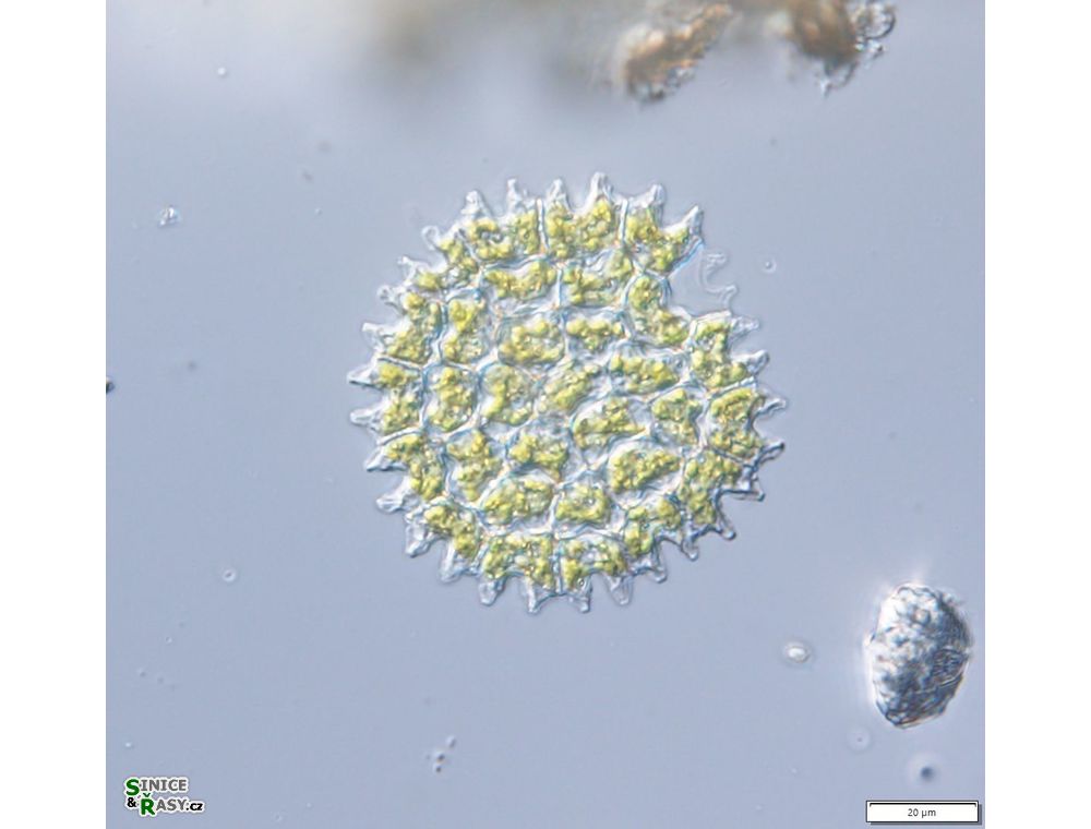 Pediastrum angulosum