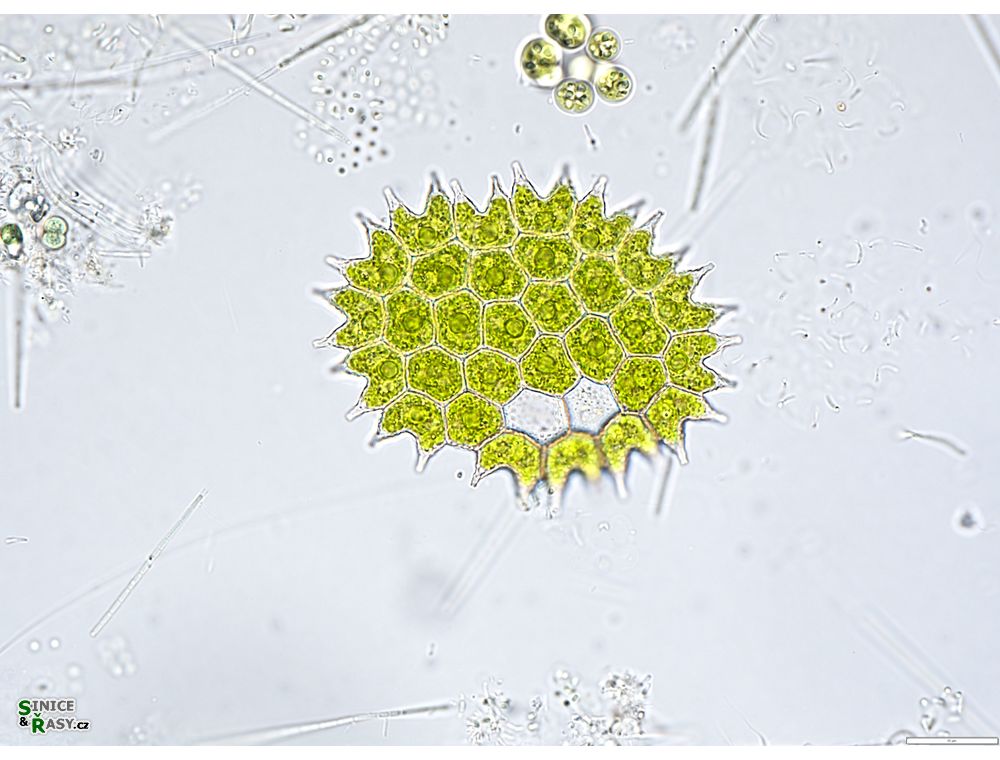 Pseudopediastrum boryanum