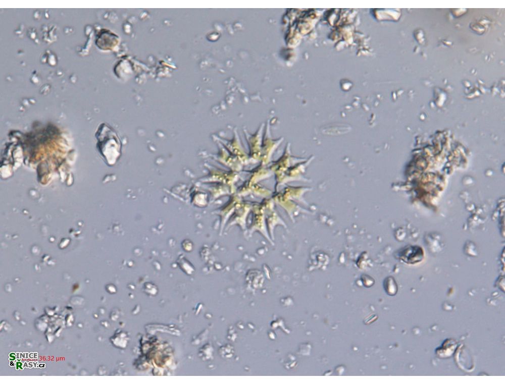 Parapediastrum biradiatum var. longicorne