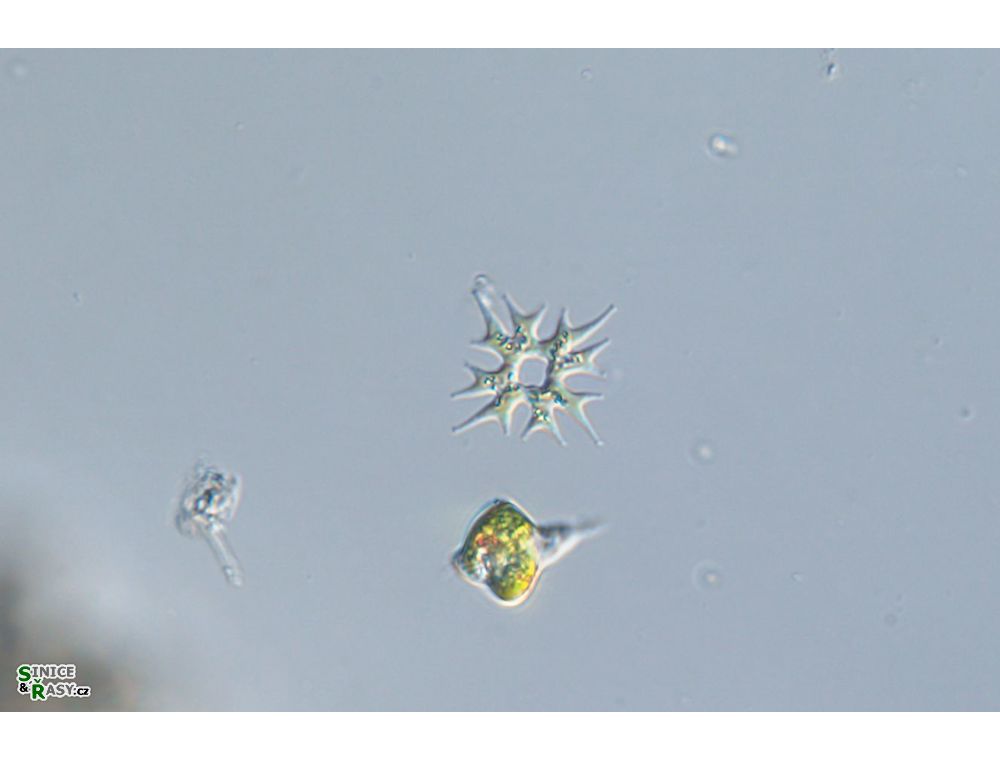 Parapediastrum biradiatum var. longicorne