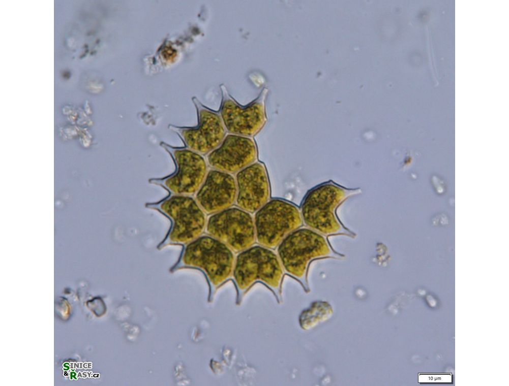 Pseudopediastrum boryanum