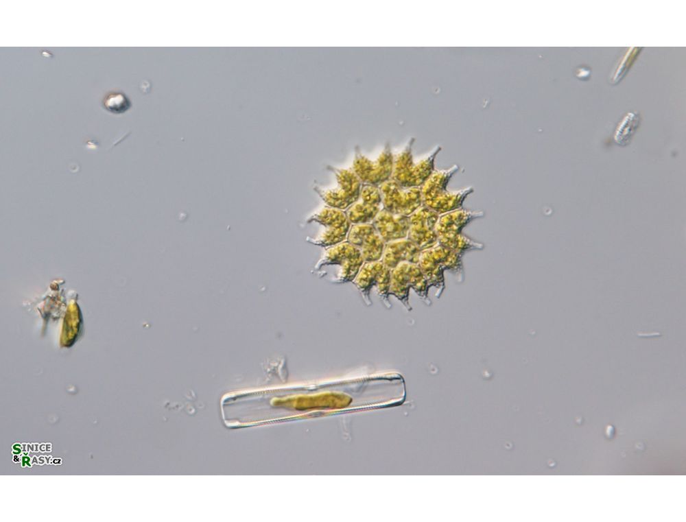 Pseudopediastrum boryanum cfr. var. longicorne