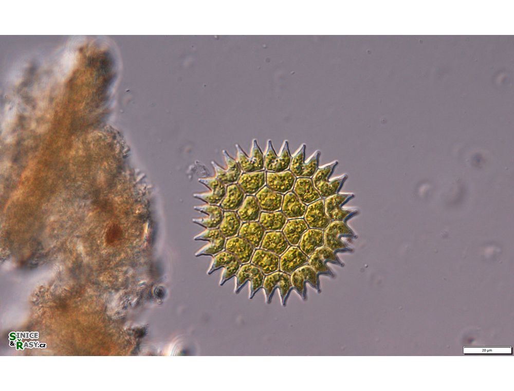 Pseudopediastrum borynaum