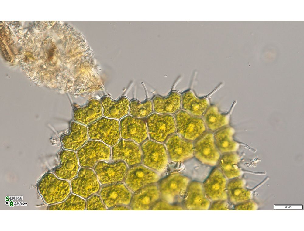 Pseudopediastrum forcipatum