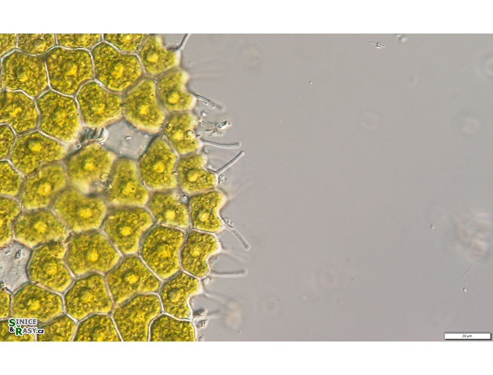 Pseudopediastrum forcipatum