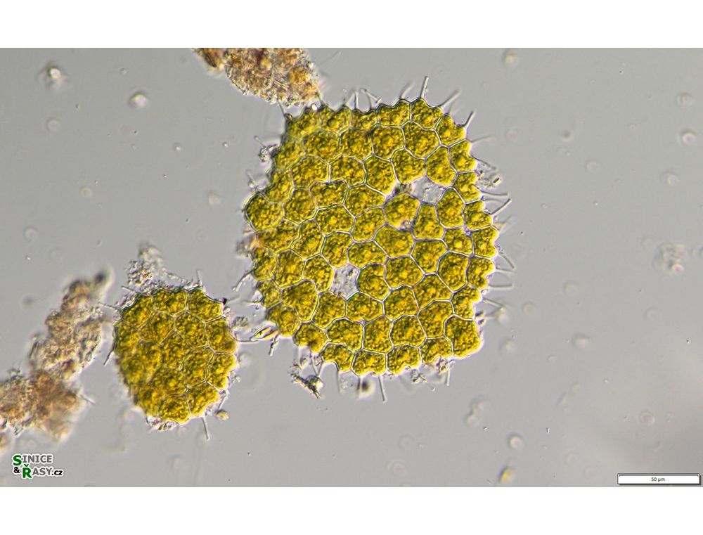 Pseudopediastrum forcipatum