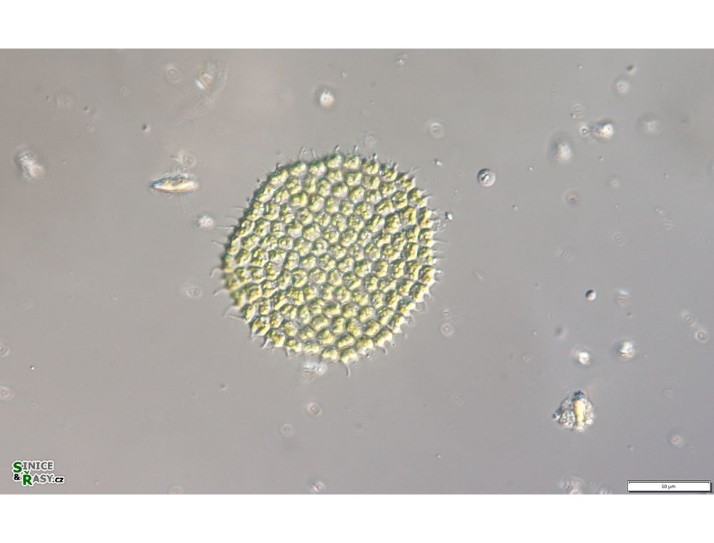 Pseudopediastrum forcipatum