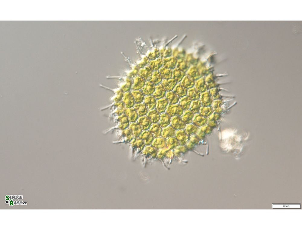 Pseudopediastrum forcipatum