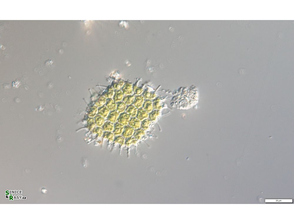 Pseudopediastrum forcipatum