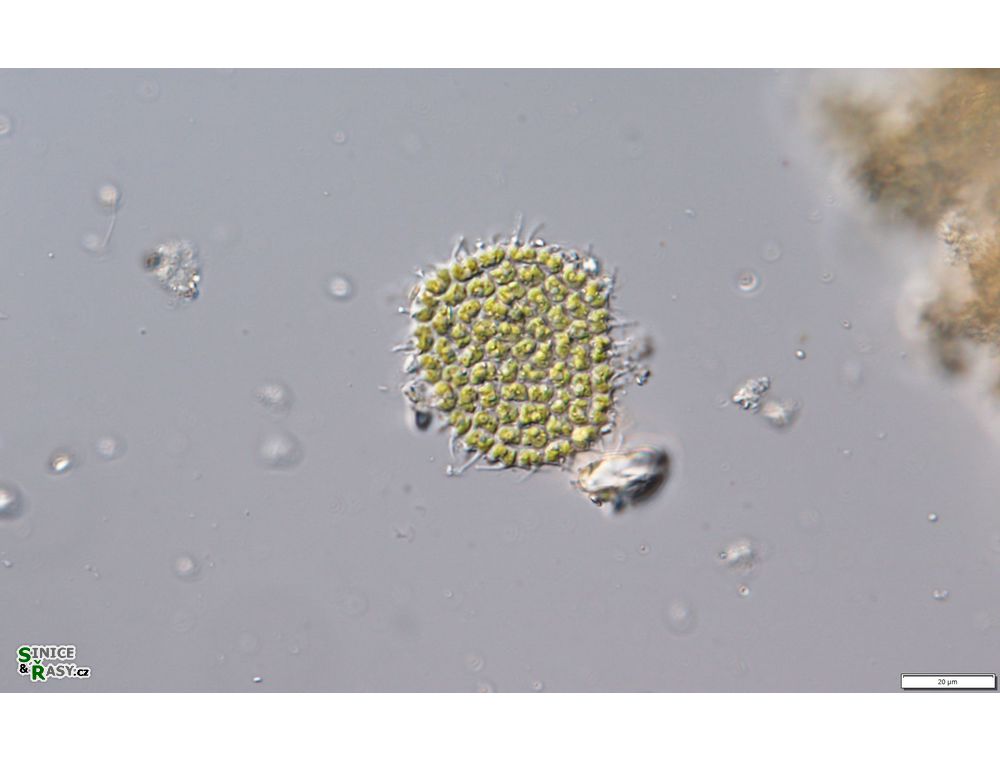 Pseudopediastrum forcipatum