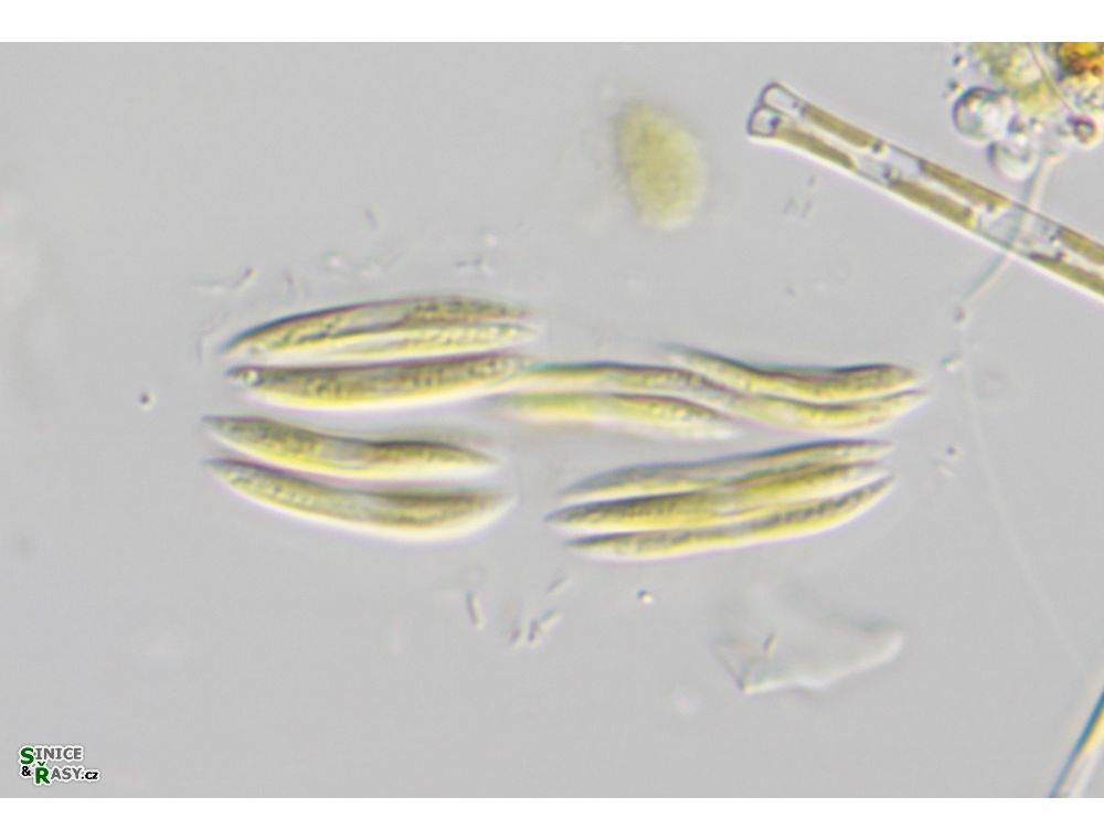 Quadrigula closterioides