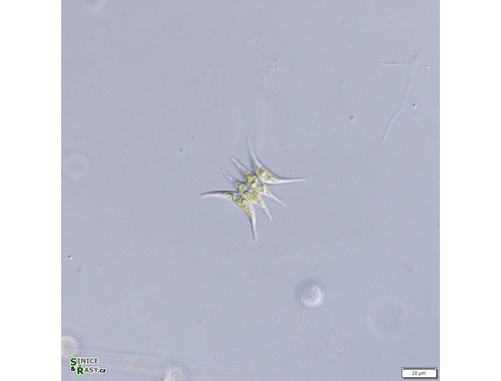 Tetradesmus lagerheimii