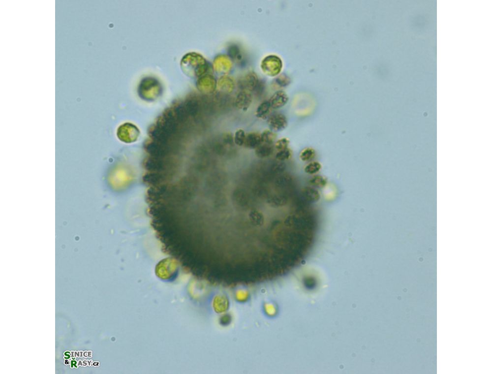 Stylosphaeridium stipitatum