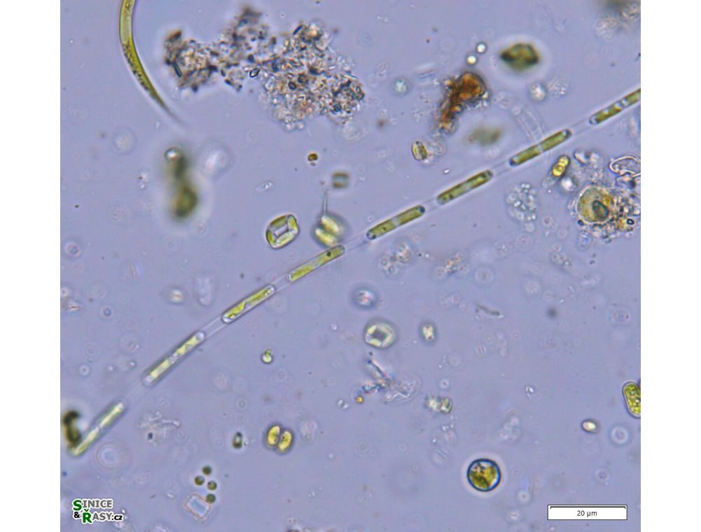 Binuclearia lauterbornii