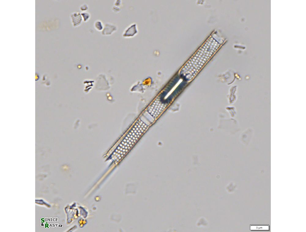 Aulacoseira granulata