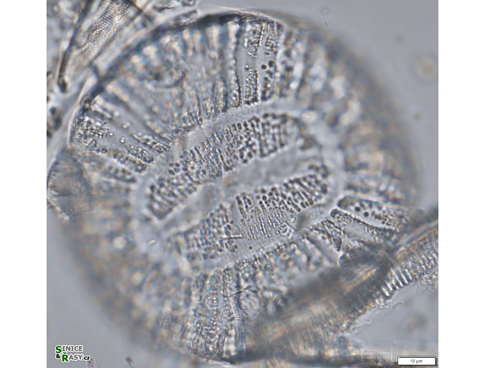 Campylodiscus clypeus