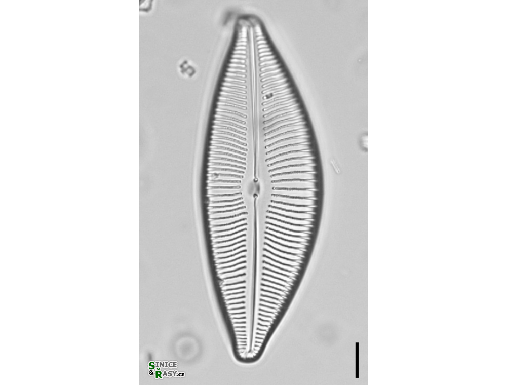 Encyonema minutum
