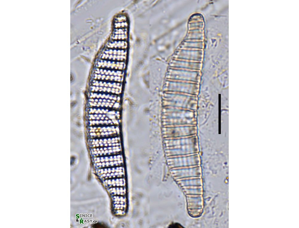 Epithemia adnata