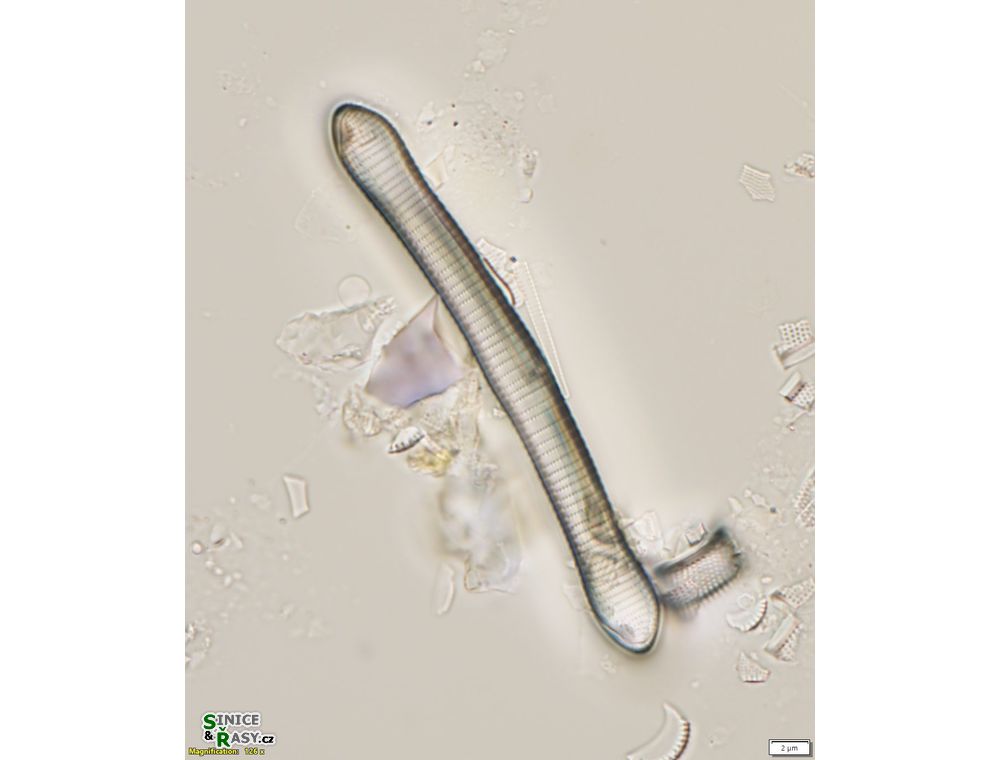 Eunotia formica