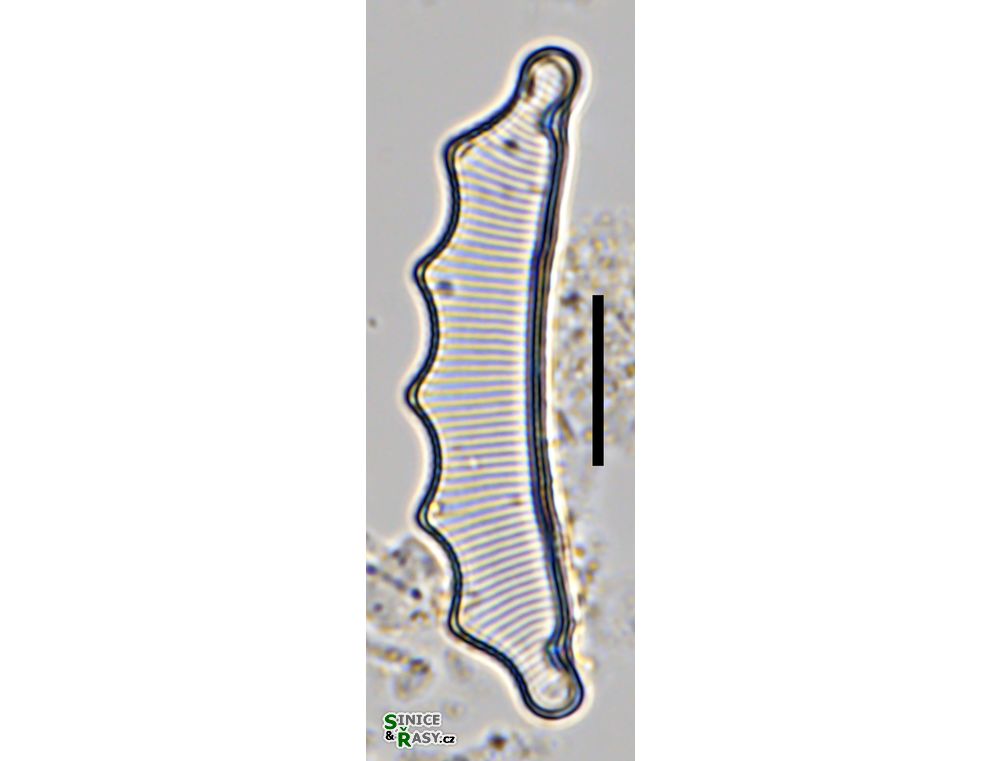 Eunotia hexaglyphis