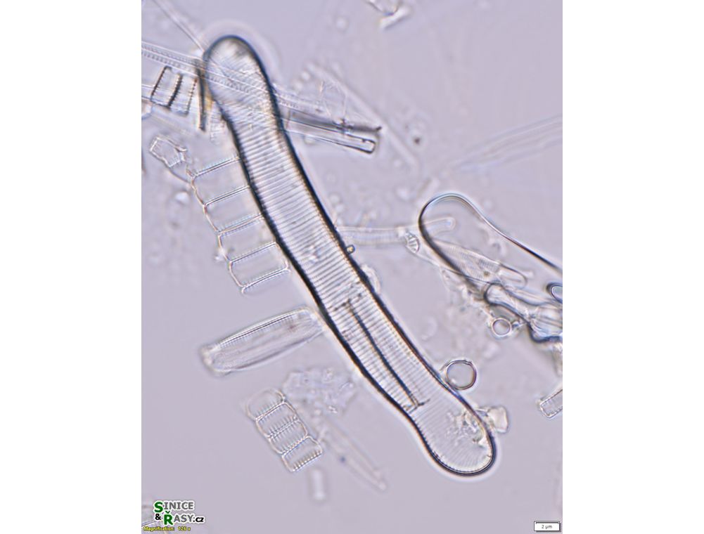 Eunotia monodon