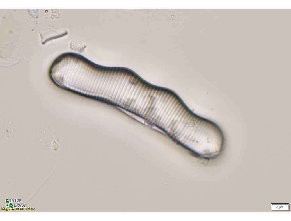 Eunotia monodon