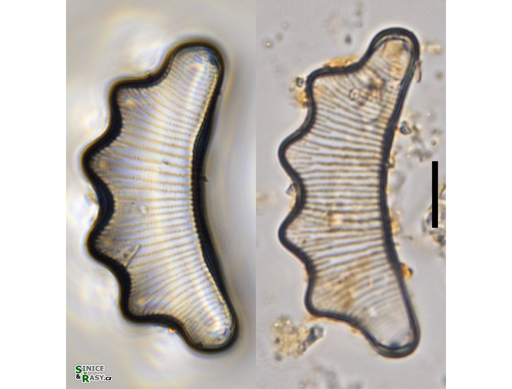 Eunotia tetraodon