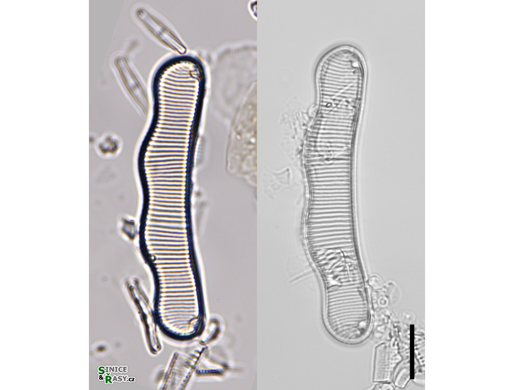 Eunotia neoscandinavica