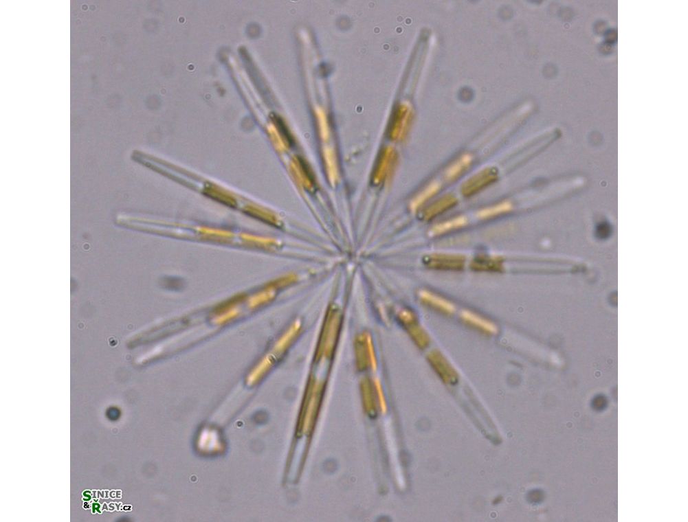 Nitzschia fruticosa