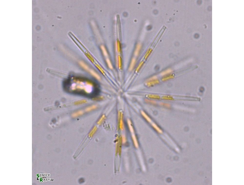 Nitzschia fruticosa