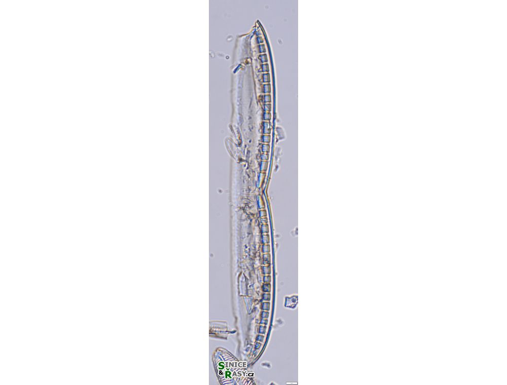 Nitzschia kittlii