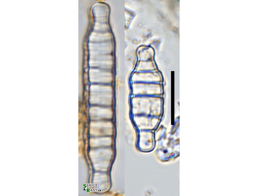 Odontidium anceps