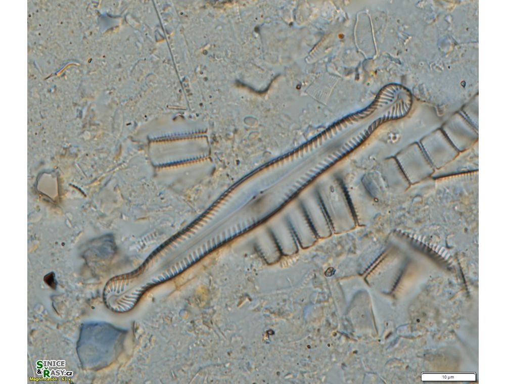 Pinnularia polyonca