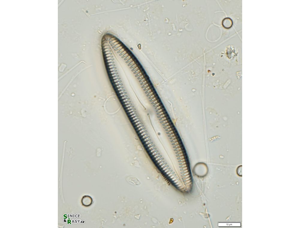 Pinnularia hemiptera