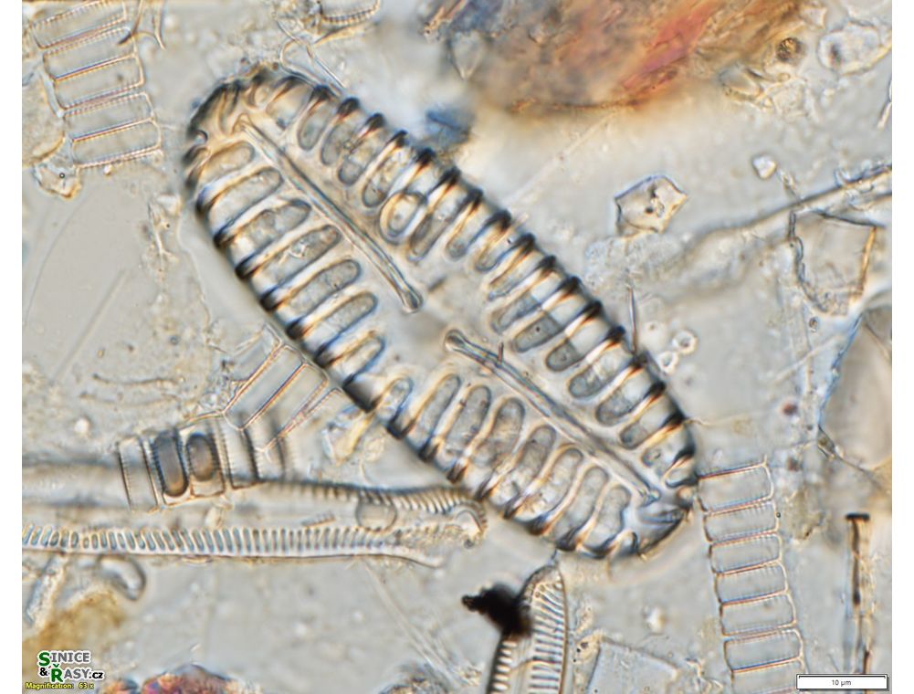 Pinnularia lata