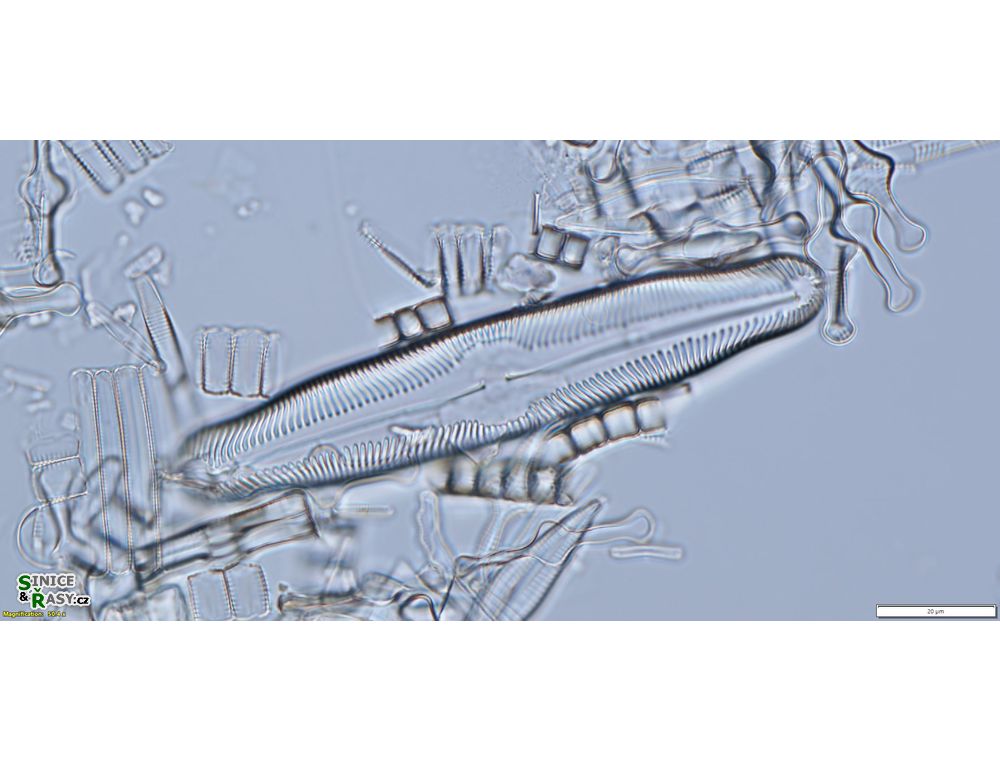 Pinnularia legumen