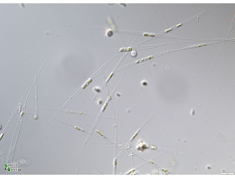 Urosolenia longiseta