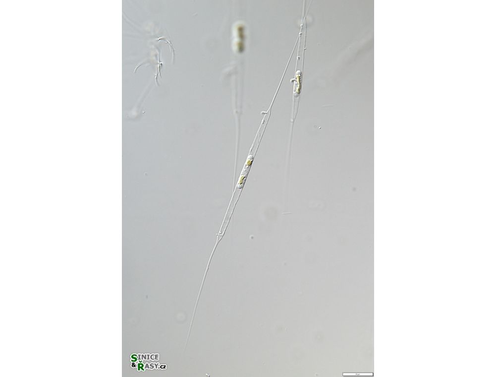 Urosolenia longiseta